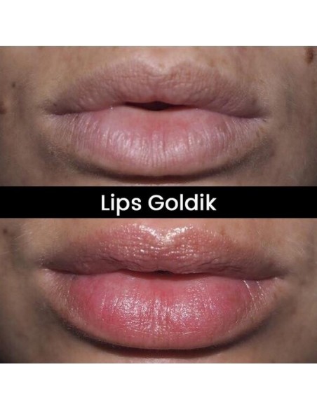 Lips Mask